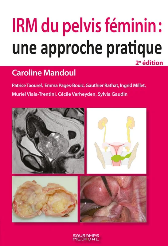 antoineonline9-1345792